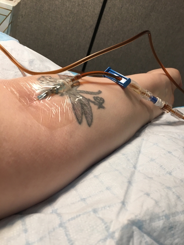 Iron Infusion - hopeful for more energy!